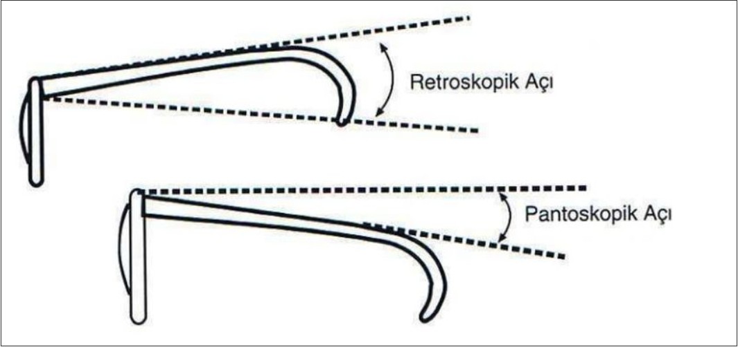 Retroskopik ve pantoskopik açı şeması